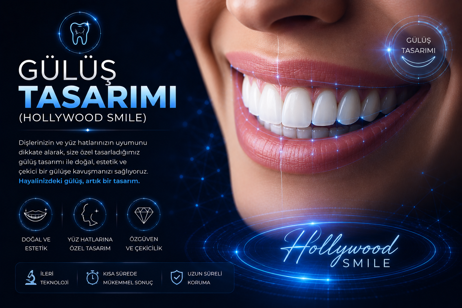 Gülüş Tasarımı (Hollywood Smile)